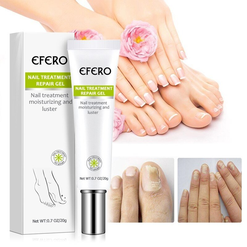 Nail Repair Gel – Nagelpflege, Anti-Pilz, Stärkung, Feuchtigkeit, Gesundes Wachstum