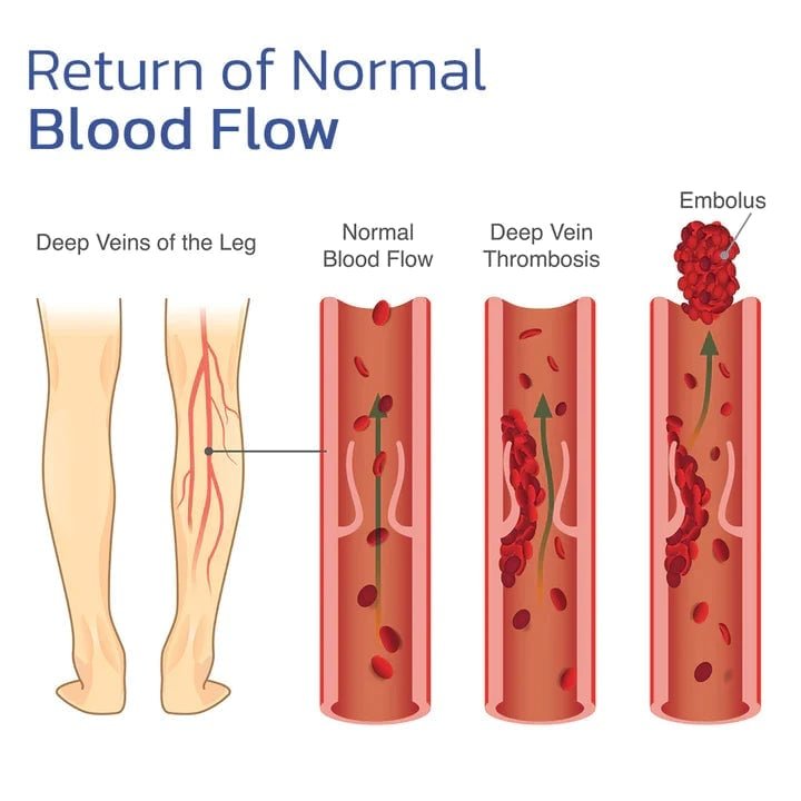 KneeBand™ – Schnelle, effektive Linderung bei Knieschmerzen und Verspannungen [50 % Rabatt]