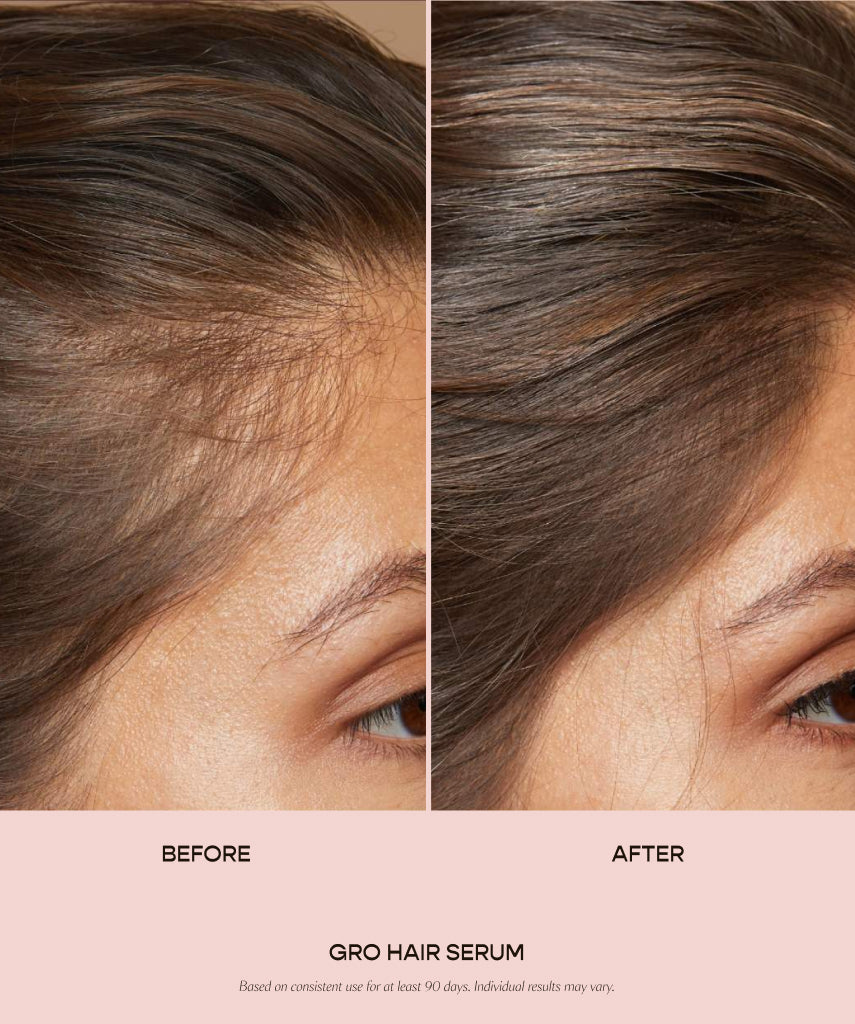 GlowRoots™ – Intensiv pflegendes Haarserum für sichtbar dichteres, gesünderes Haar [50 % Rabatt]