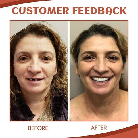 SecureSmile™ – Schmerzfreie Sicherheit & fester Halt für deinen Zahnersatz [50 % Rabatt]