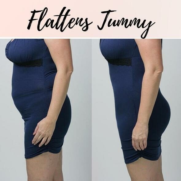 SlimShape™ – Bauch-Shaper mit Kreuzkompression für eine definierte Silhouette [1+1 Gratis]