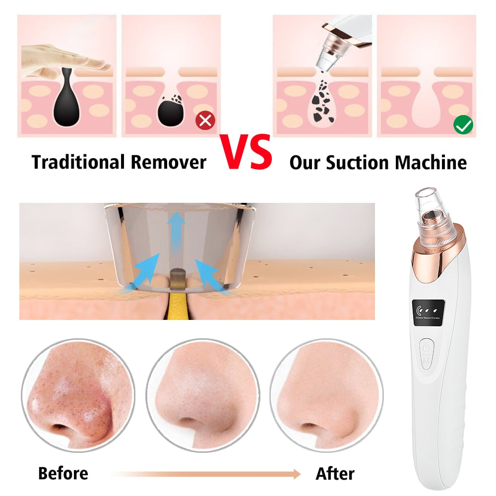 50% Rabatt | ClearSkin™ - Perfekte Haut ist das Ziel! [Letzter Tag Rabatt]