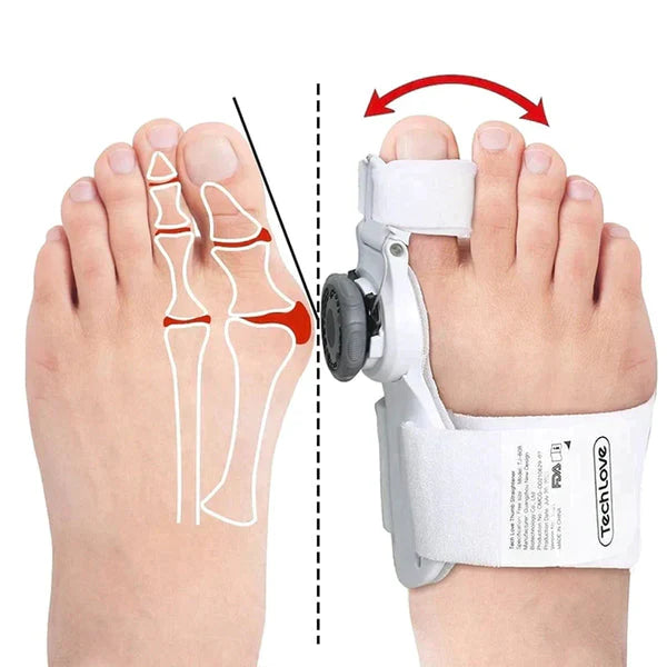 Alignix™ – Universelle Hallux Valgus-Korrekturvorrichtung | 50% Rabatt