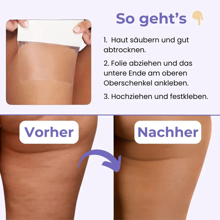 SlimPatch™ Unsichtbare Beinstraffung | 50% Rabatt