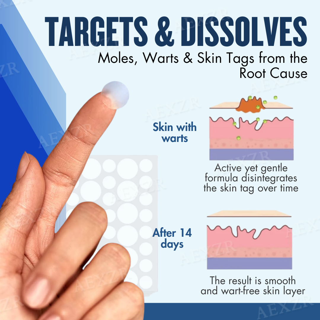 1 + 1 Gratis | ClearSkin™ Effektive Entfernung von Muttermalen und Warzen [Letzter Tag Rabatt]