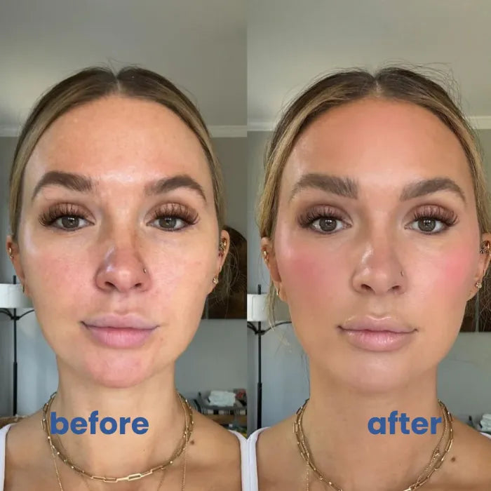BrightSkin™ – Beruhigende Pflege für perfekte, strahlende Haut [1 + 1 Gratis]