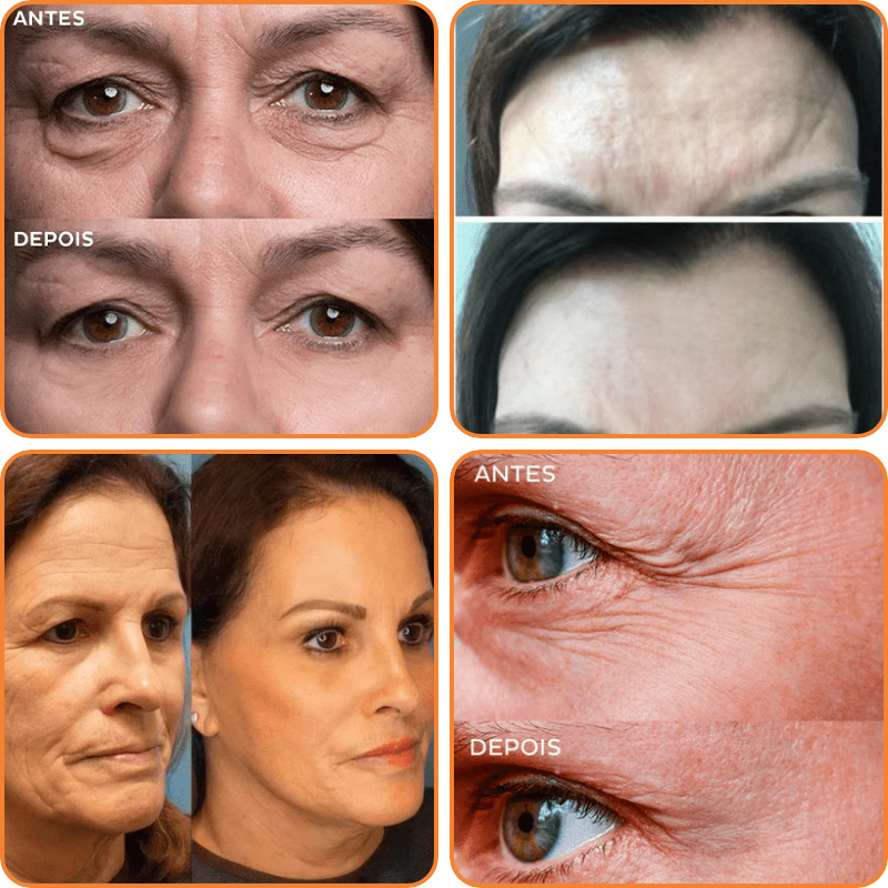 1 + 1 Gratis | SleekSkin™ - Alterslose Schönheit Ausstrahlung [Letzter Tag Rabatt]