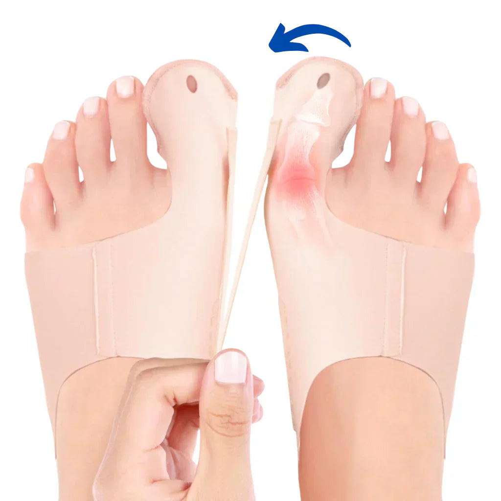 HalluxValgus™ - Ihre komfortable Lösung für schmerzfreie Füße! [1 + 1 Gratis]