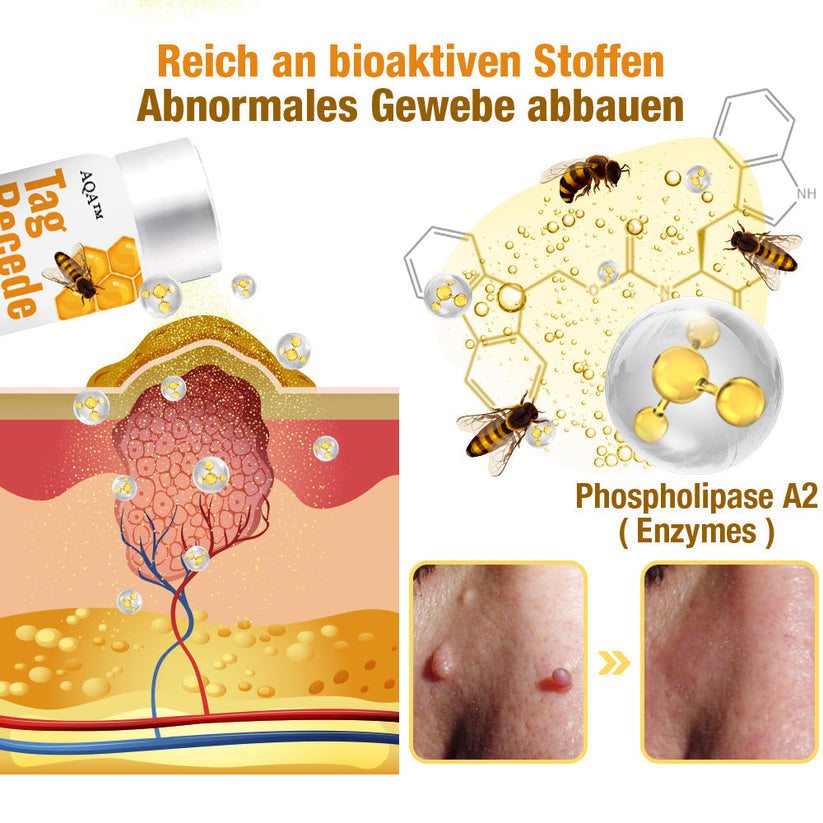 Hautpflege Creme für Flecken, Muttermale & Warzen – natürliche Hautregeneration