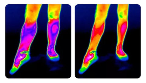 KneeBand™ – Schnelle, effektive Linderung bei Knieschmerzen und Verspannungen [50 % Rabatt]