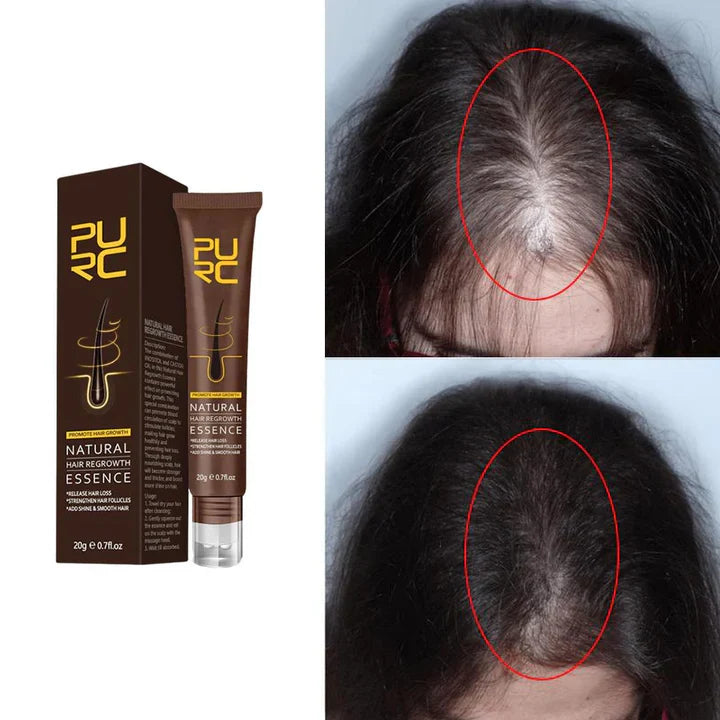 HairPurc™ Natürliches Haarwuchsöl | 1 + 1 Gratis