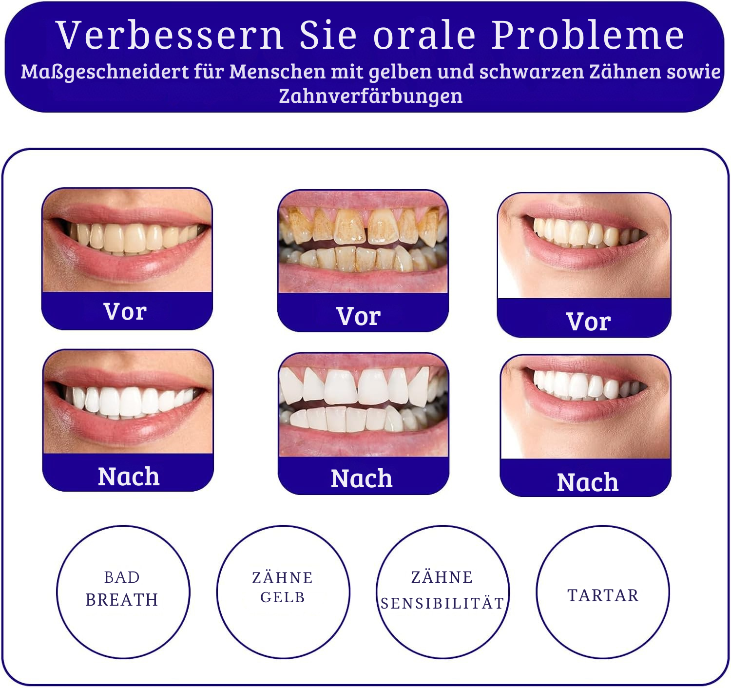 HeroSmile™ – Farbkorrektur-Serum & lila Zahnpasta für strahlend weiße Zähne [1 + 1 Gratis]