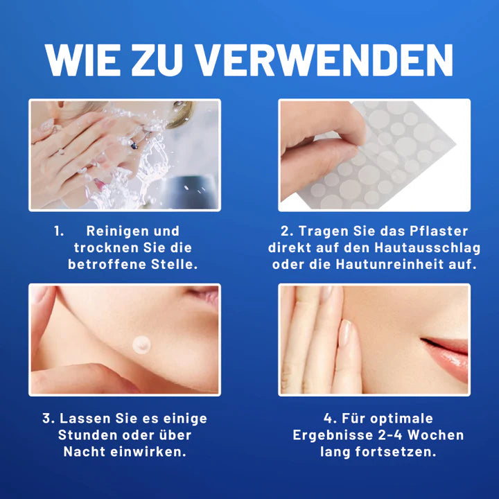 TagAway™ – Pflaster zur Entfernung von Hautanhängern und Warzen | 50% Rabatt