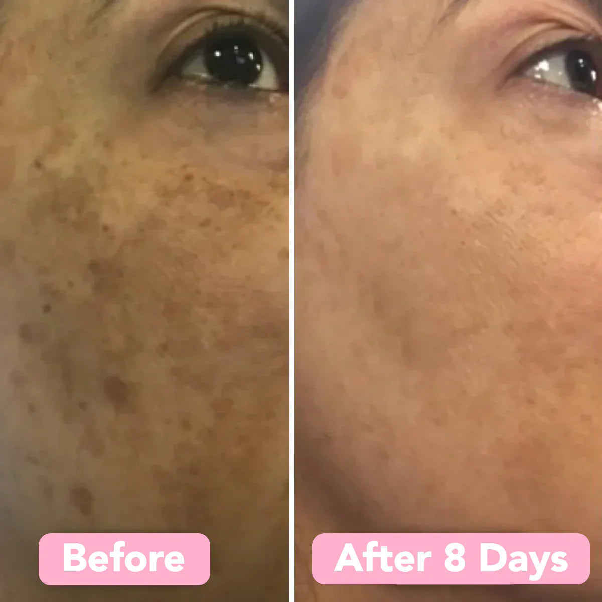 BrightEase™ – Enthülle strahlende, gleichmäßige & makellose Haut, die Blicke auf sich zieht [2 + 2 Gratis]