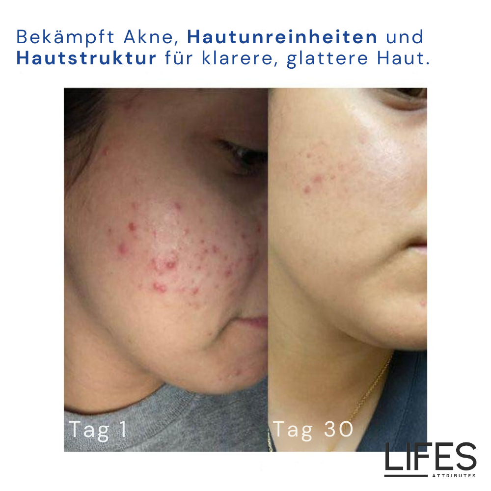 AgeDefy™ – Für einen jugendlich strahlenden und gesunden Teint [50 % Rabatt]