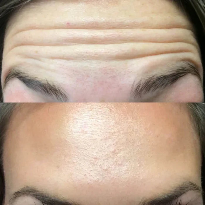 GlowLift™ – Porenstraffende und Hautstraffende Packung | 50% Rabatt