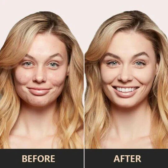 50% Rabatt | Chafful™ - Pilzkopf Luftkissen CC Creme