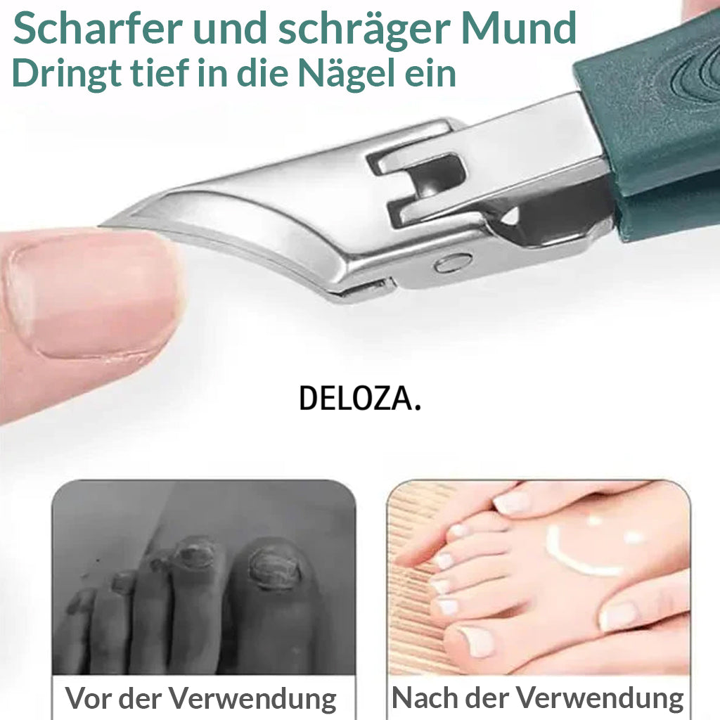 MultiClip™ 3-teiliges Nagelpflege-Set für eingewachsene Nägel [50% Rabatt]