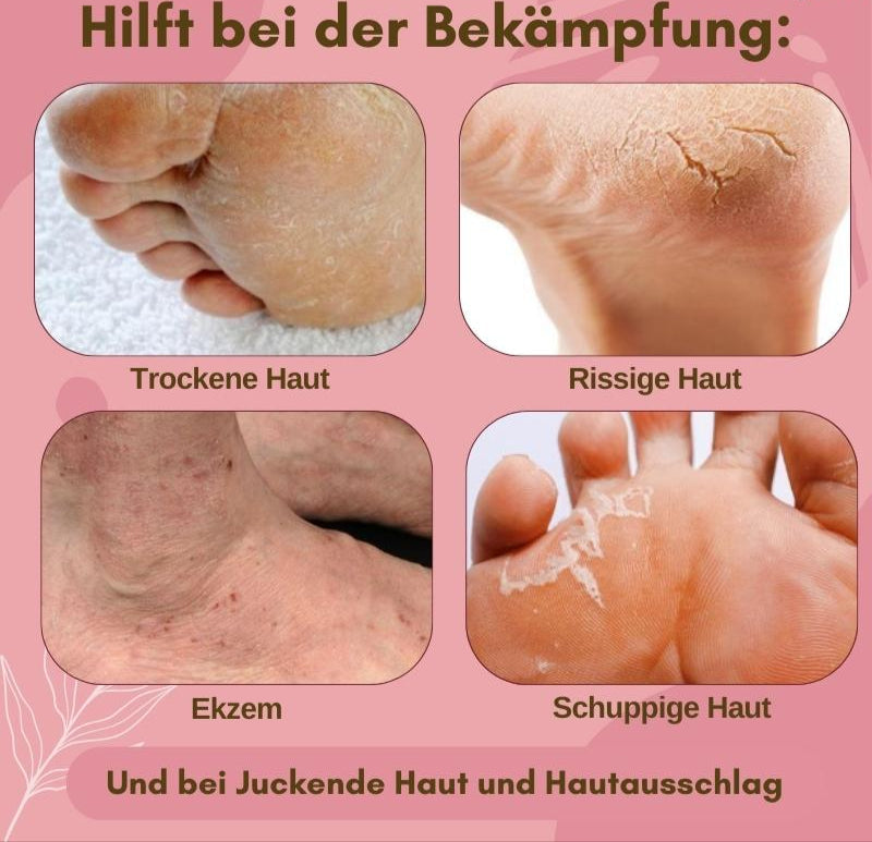 FootCare™ – Gegen Pilz, Ekzeme & rissige Haut, regenerierend, feuchtigkeitsspendend & mit Arnika [1 + 1 Gratis]