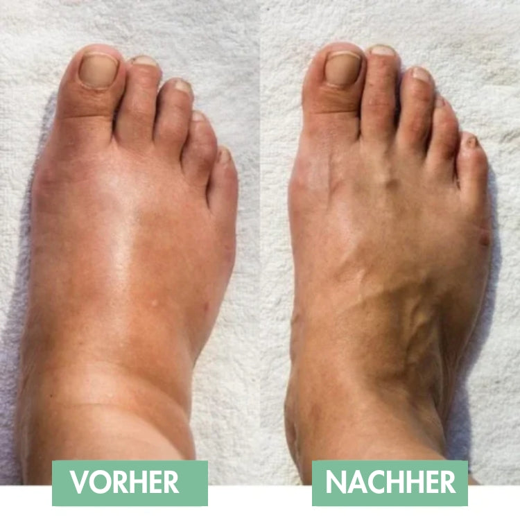 Revivax™ - Die innovative EMS-Fußmassage für sofortige Erleichterung! [50% Rabatt]