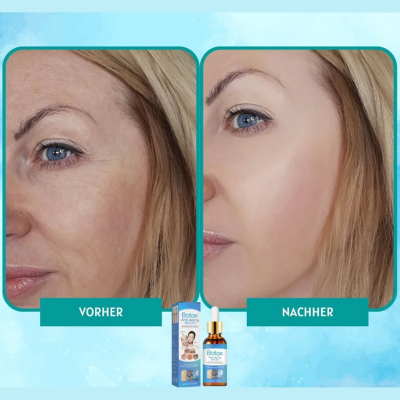 YouthGlow™ – Botox-freies Anti-Aging-Serum für strahlende, jugendliche Haut [1 + 1 Gratis]