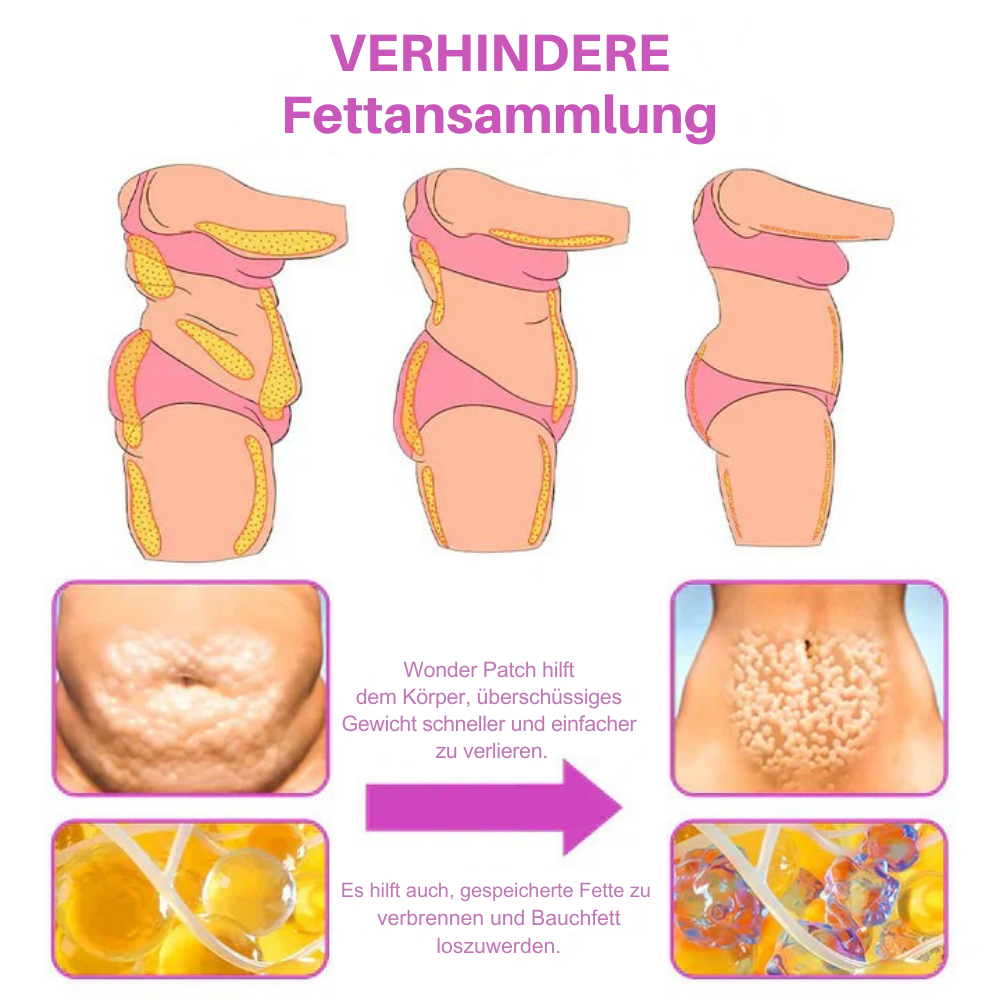 SlimTone™ – Selbstbewusst mit flachem Bauch [50 % Rabatt]