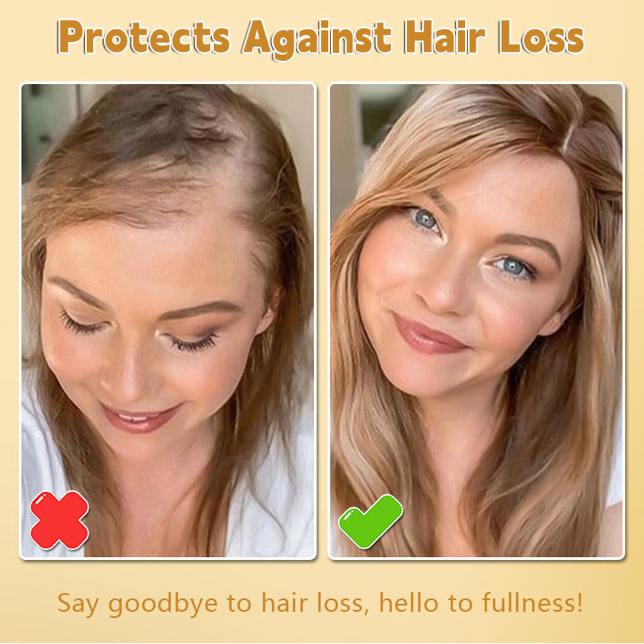 Biotin™ - Biotin-Haarspray Gegen Haarausfall Und Brüchigkeit [1 + 1 Gratis]