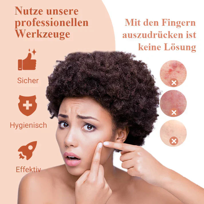 ClearSkin™ – Präzise Mitesserentfernung für glatte, reine & strahlende Haut [50% Rabatt]