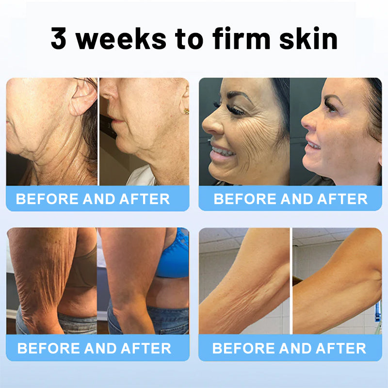 1 + 1 Gratis | Venomi™ – Luxuriöser Lifting-Stick mit Bienengift & Peptiden