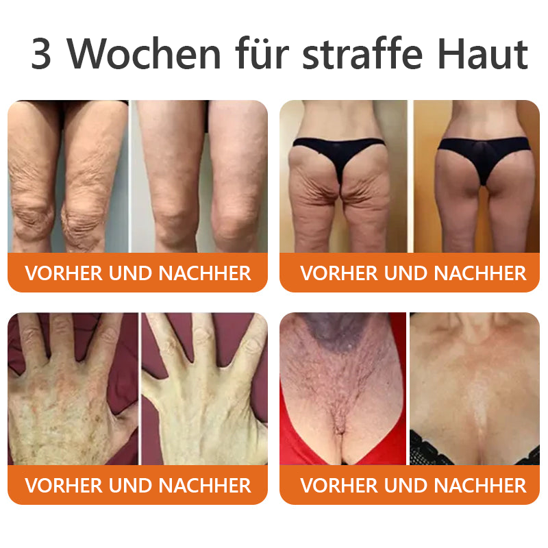 1 + 1 Gratis | SkinRepair™ - Sanfte Hautpflege für die Familie | Ohne Kortison & Nebenwirkungen