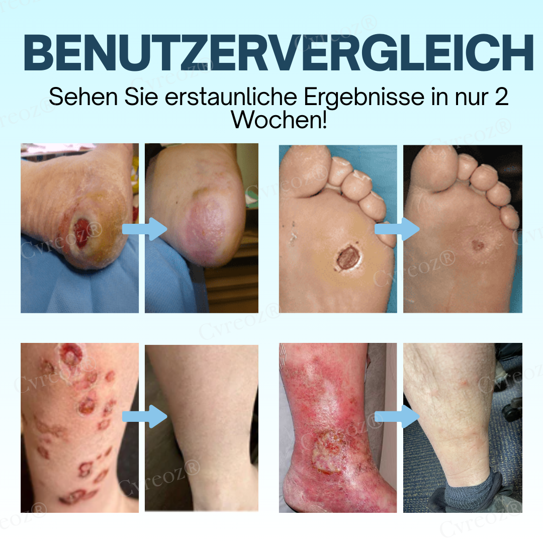 GlucoHeal™ – Spendet Feuchtigkeit und schützt [50% Rabatt]