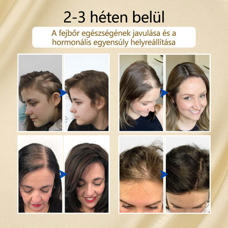 Timilk™ – VitaStrand Biotin Spray zur Förderung des Haarwachstums für dichtes, glänzendes Haar [1 + 1 Gratis]