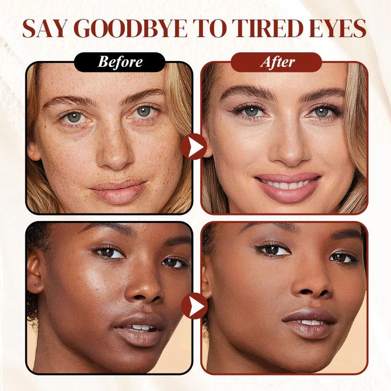 EyeBright™ – Abdeckstift für Dunkle Augenringe und Sommersprossen | 1 + 1 Gratis