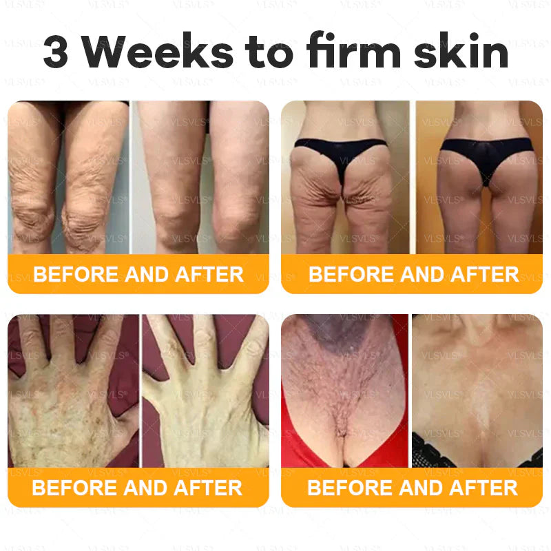 Venlure™ – Verjüngende Bienengift-Creme für glattere & strahlendere Haut [50% Rabatt]