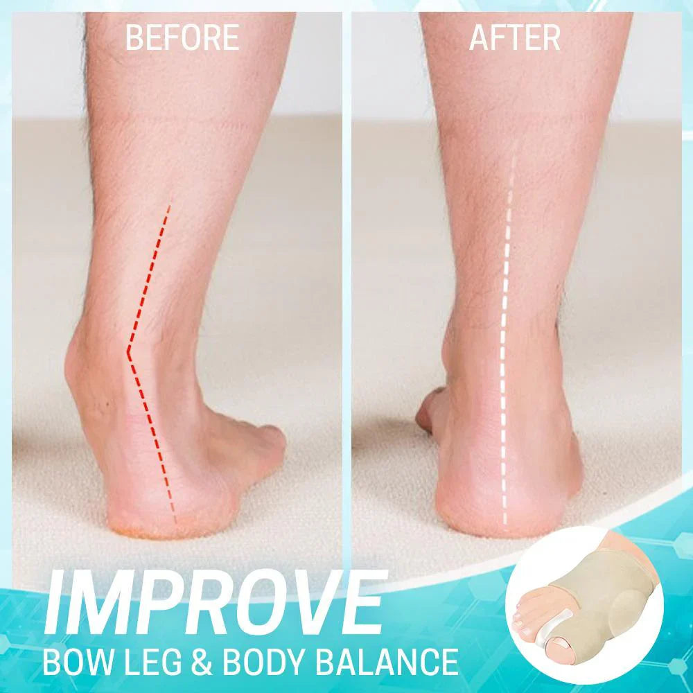 Dr.Fit Ballenzeh Korrekturhülse – Hallux Valgus Zehenspreizer für Schmerzlinderung & Fußausrichtung