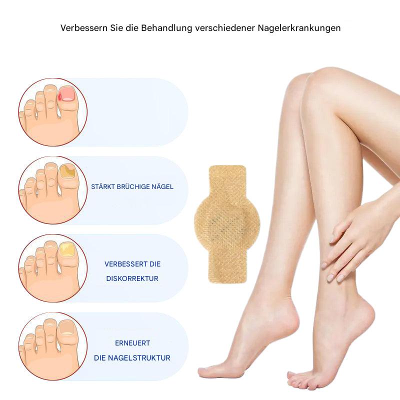 Nailox™ – Für klare, gesunde Nägel mit diskreter Pflege den ganzen Tag lang [1 + 1 Gratis]
