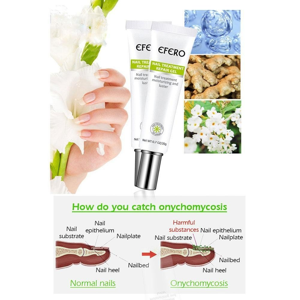 Nail Repair Gel – Nagelpflege, Anti-Pilz, Stärkung, Feuchtigkeit, Gesundes Wachstum