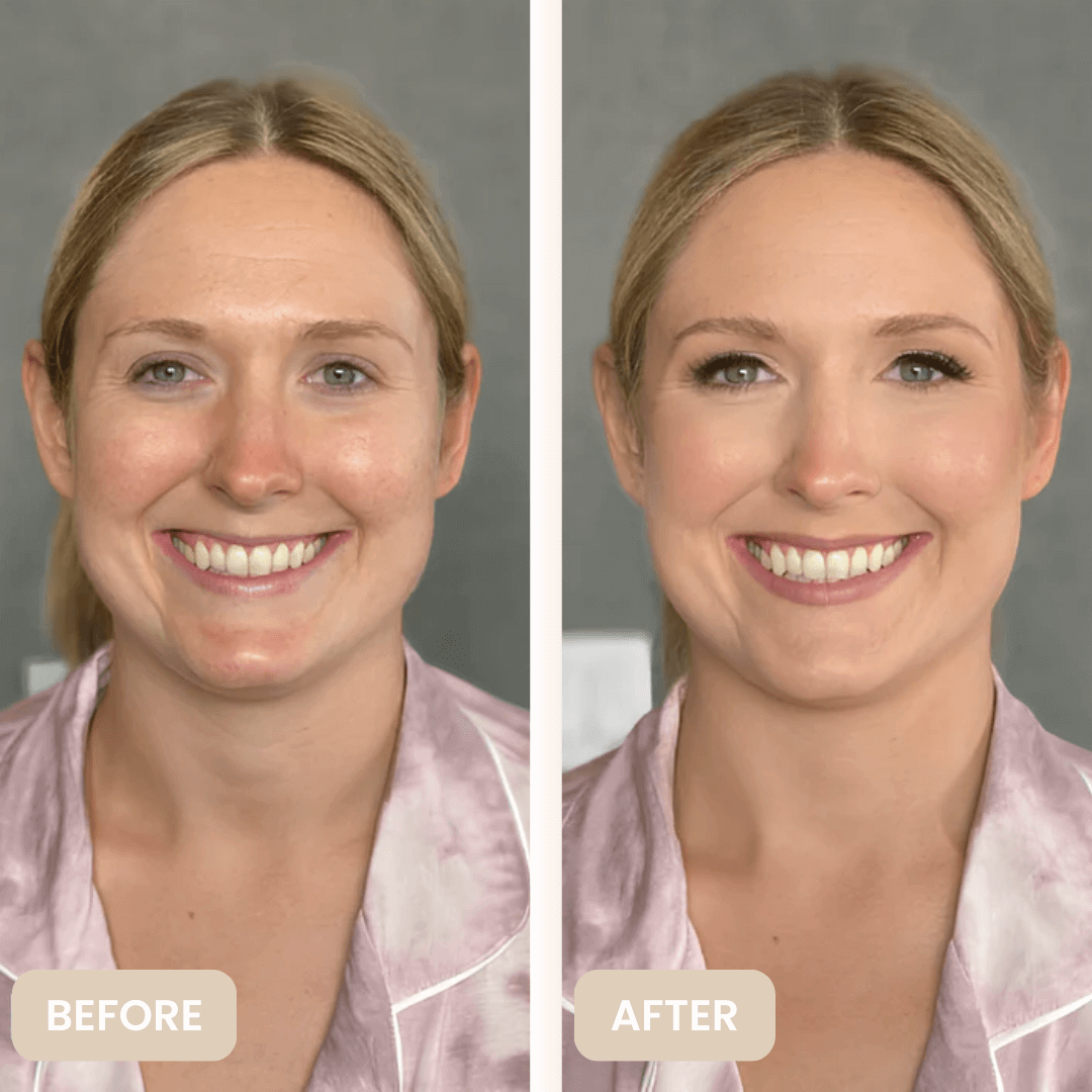 LumaLux™ – Verwandle deinen Teint in einen jugendlichen Glow, den niemand übersehen kann [50% Rabatt]