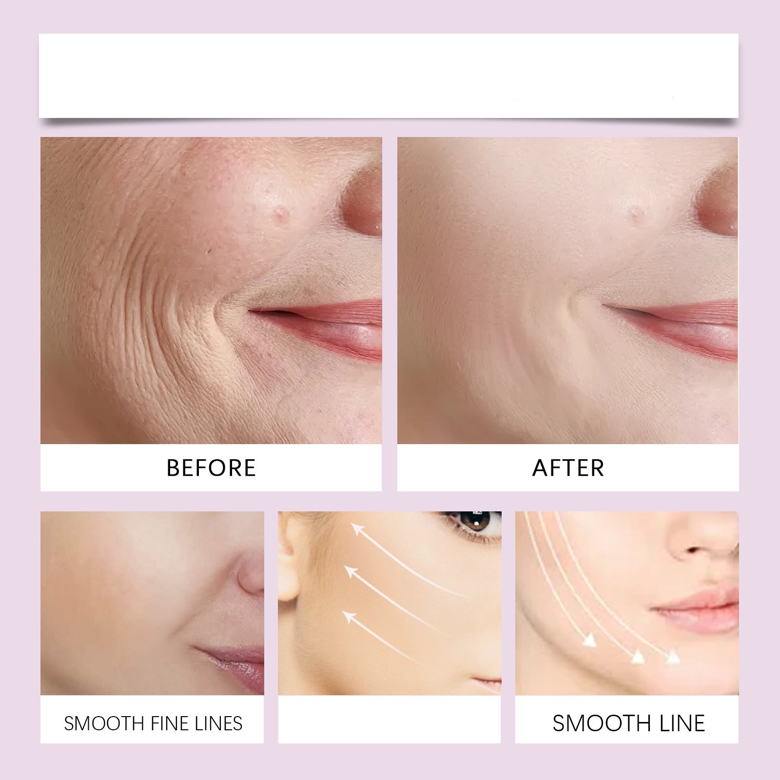 LuxLift™ – Hebt Ihr Kinn und verleiht jugendliche Ausstrahlung in Sekunden [50 % Rabatt]