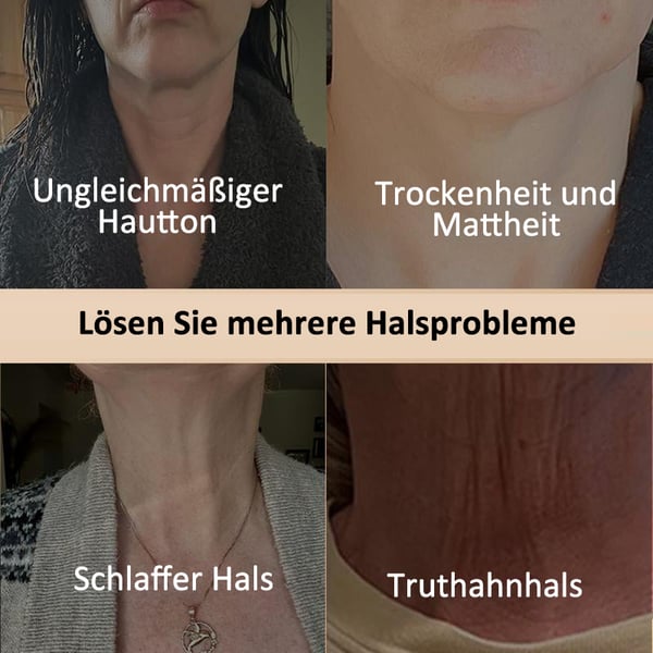1 + 1 Gratis | Firmify™ - Straffende Hals- und Körpercreme