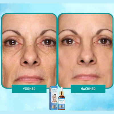 YouthGlow™ – Botox-freies Anti-Aging-Serum für strahlende, jugendliche Haut [1 + 1 Gratis]