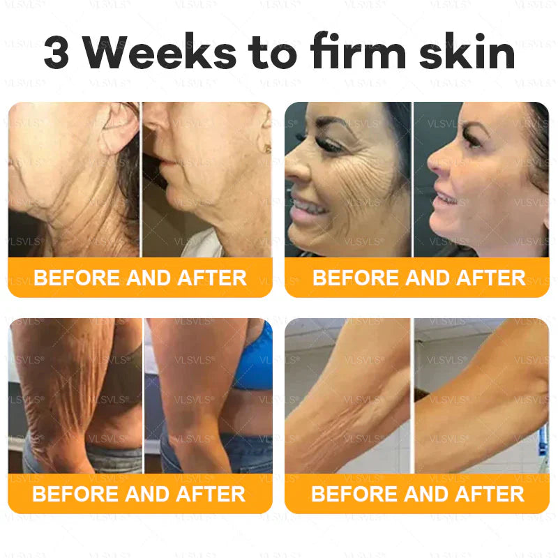 Venlure™ – Verjüngende Bienengift-Creme für glattere & strahlendere Haut [50% Rabatt]