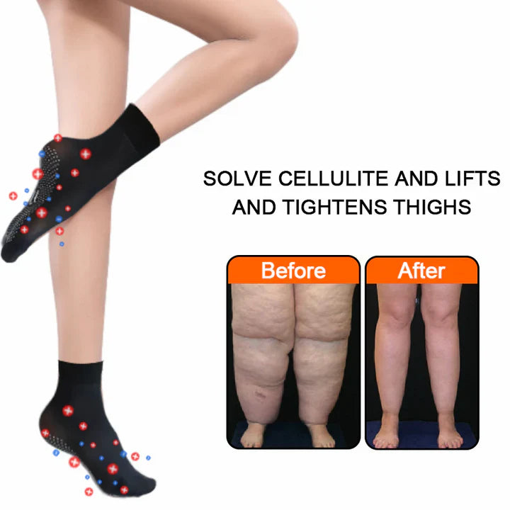 ShapeSocks™ – Der ultimative Trick zur Beschleunigung Ihrer Gewichtsabnahme [1 + 1 Gratis]