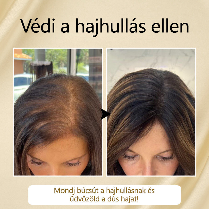 Timilk™ – VitaStrand Biotin Spray zur Förderung des Haarwachstums für dichtes, glänzendes Haar [1 + 1 Gratis]