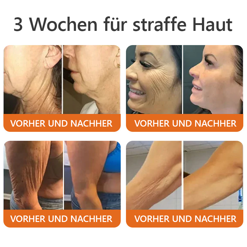 1 + 1 Gratis | SkinRepair™ - Sanfte Hautpflege für die Familie | Ohne Kortison & Nebenwirkungen