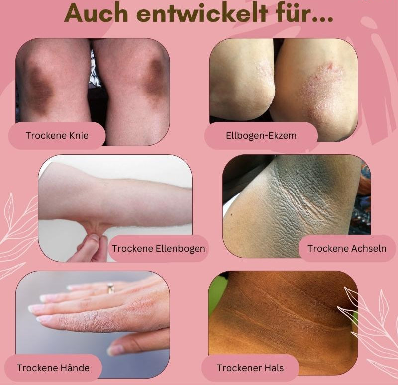 FootCare™ – Gegen Pilz, Ekzeme & rissige Haut, regenerierend, feuchtigkeitsspendend & mit Arnika [1 + 1 Gratis]
