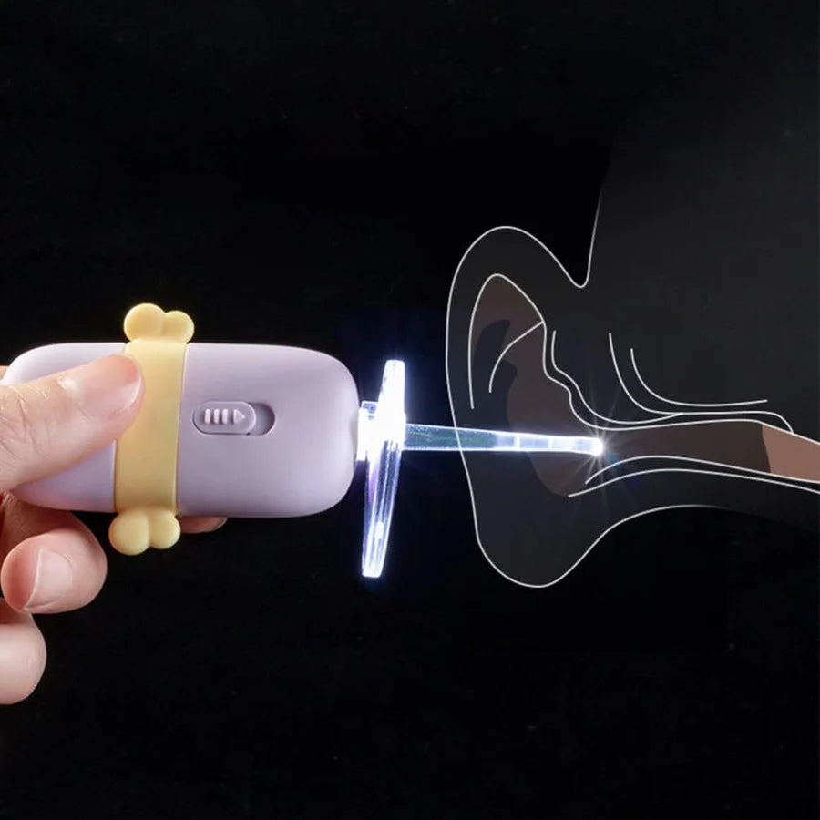 EarScope™ – Sanftes Ohrenschmalz-Entfernungsset für Kinder | 50% Rabatt