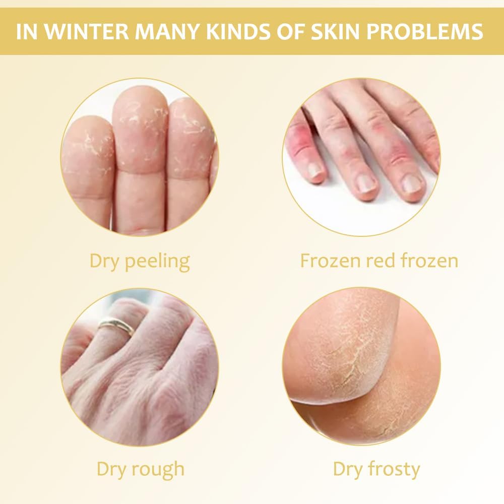 SkinShiner™ – Intensive Pflege für trockene Haut zur Reparatur und Regeneration [1 + 1 Gratis]