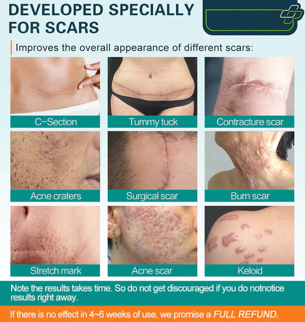 1+1 Gratis | ScarRemove™ - Schnellere narbenfreie Haut