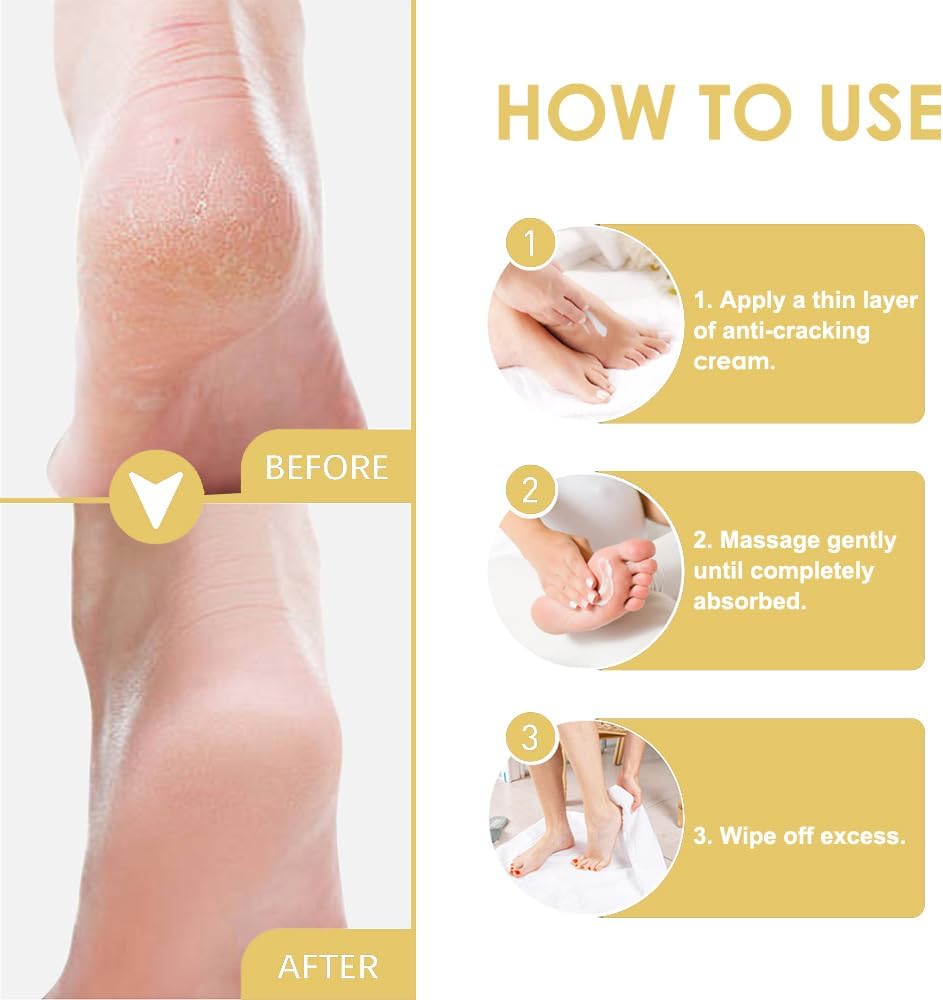 SkinShiner™ – Intensive Pflege für trockene Haut zur Reparatur und Regeneration [1 + 1 Gratis]